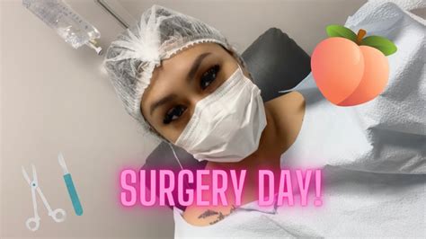 3 Month Follow Up, Transgender Patient 360 Liposuction, BBL.